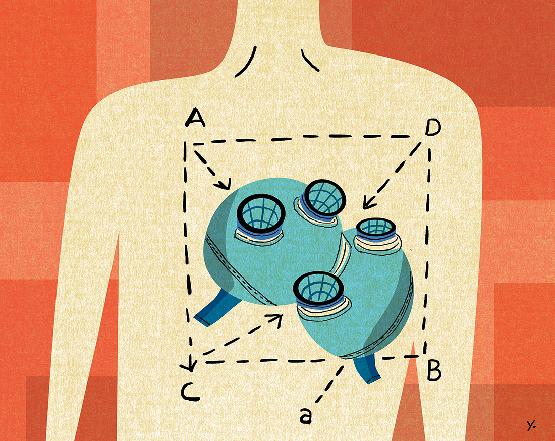 Mormon Inventions: Artificial Heart